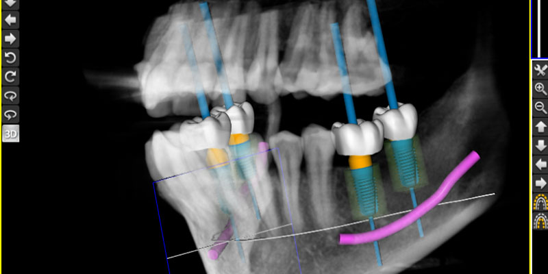 Digitales 3D-Röntgen von adentes Zahnärzte aus St. Augustin