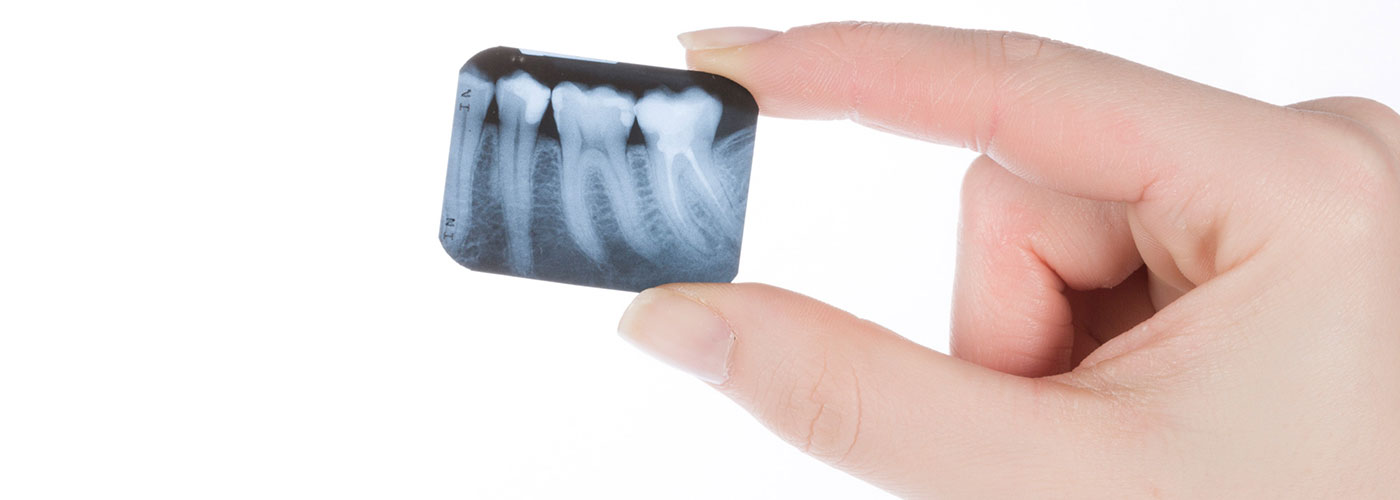Wurzelkanalbehandlung bei adentes Zahnarzt und MVZ