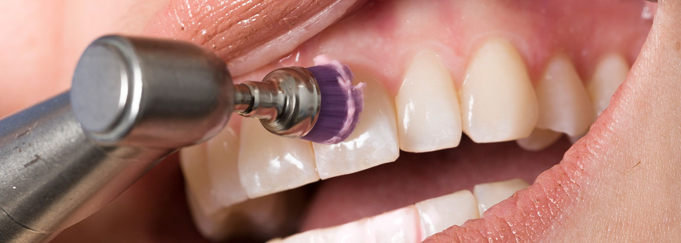 Professionelle Zahnreinigung bei adentes